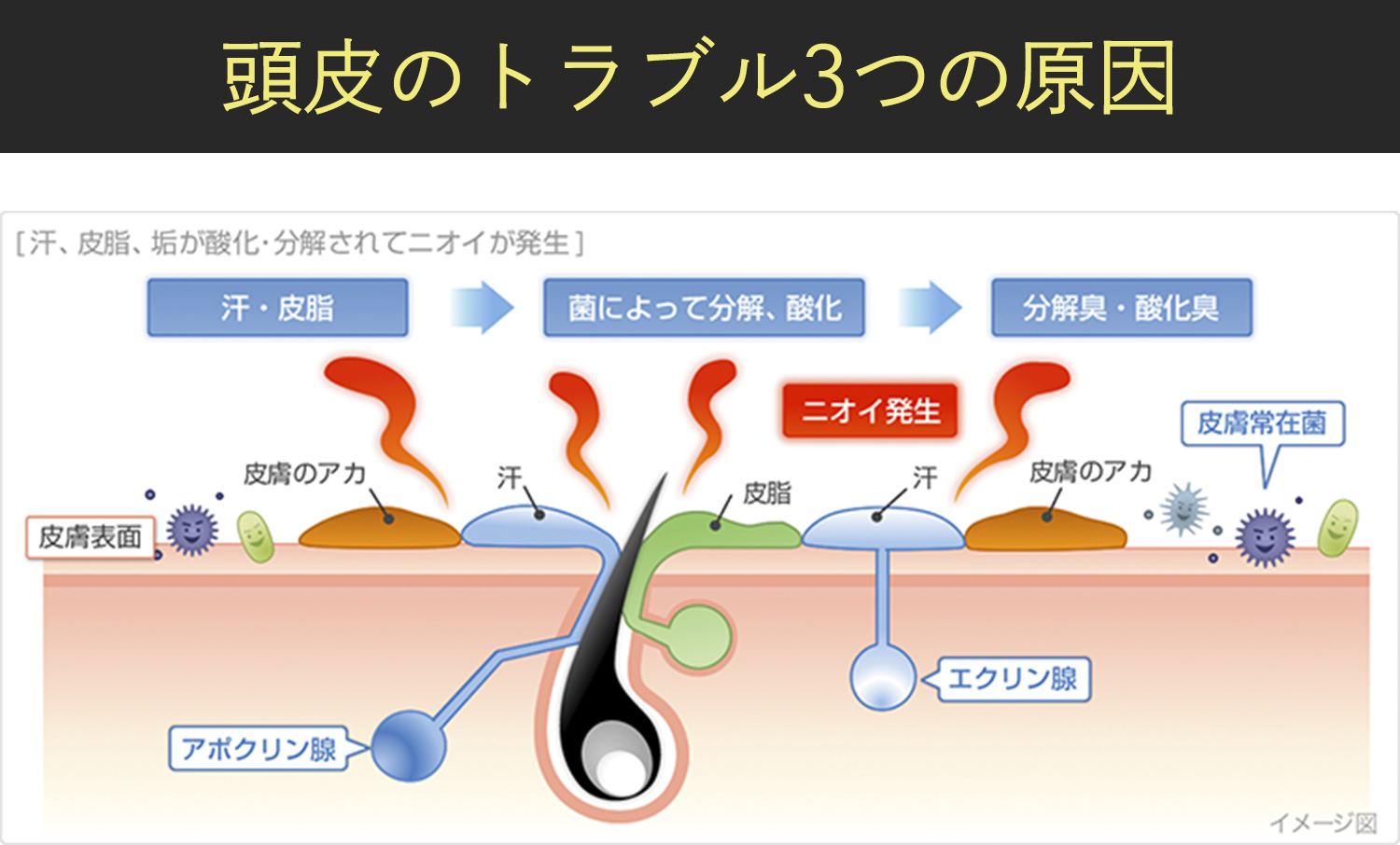 頭皮のトラブル3つの原因